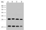 CRP Antibody in Western Blot (WB)