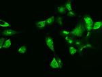 Galectin 7 Antibody in Immunocytochemistry (ICC/IF)