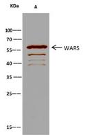 WARS Antibody in Immunoprecipitation (IP)