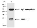 MAD2 Antibody in Immunoprecipitation (IP)