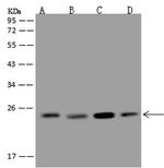 MAD2 Antibody in Western Blot (WB)