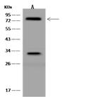 KBP Antibody in Western Blot (WB)