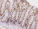 ICT1 Antibody in Immunohistochemistry (Paraffin) (IHC (P))