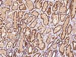 ATP5H Antibody in Immunohistochemistry (Paraffin) (IHC (P))