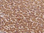 ATP5H Antibody in Immunohistochemistry (Paraffin) (IHC (P))