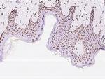 EWSR1 Antibody in Immunohistochemistry (Paraffin) (IHC (P))