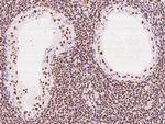 EWSR1 Antibody in Immunohistochemistry (Paraffin) (IHC (P))