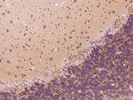 DYNC1LI1 Antibody in Immunohistochemistry (Paraffin) (IHC (P))