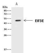 eIF3e Antibody in Immunoprecipitation (IP)