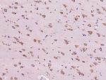 RAB5IF Antibody in Immunohistochemistry (Paraffin) (IHC (P))