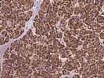 RPS5 Antibody in Immunohistochemistry (Paraffin) (IHC (P))