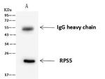 RPS5 Antibody in Immunoprecipitation (IP)