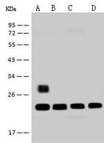 RPS5 Antibody in Western Blot (WB)