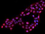 LAP2 Antibody in Immunocytochemistry (ICC/IF)