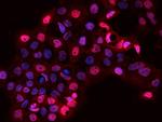 SARNP Antibody in Immunocytochemistry (ICC/IF)