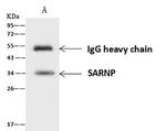 SARNP Antibody in Immunoprecipitation (IP)