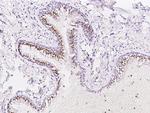 PAPSS1 Antibody in Immunohistochemistry (Paraffin) (IHC (P))