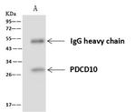 PDCD10 Antibody in Immunoprecipitation (IP)