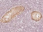 PGAM1 Antibody in Immunohistochemistry (Paraffin) (IHC (P))