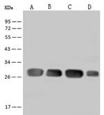 DENR Antibody in Western Blot (WB)