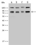 SRP72 Antibody in Western Blot (WB)