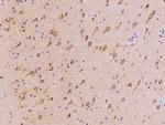 MAP1 Antibody in Immunohistochemistry (Paraffin) (IHC (P))