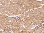 MYH7 Antibody in Immunohistochemistry (Paraffin) (IHC (P))