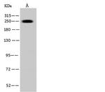 MYH7 Antibody in Western Blot (WB)