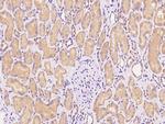 USE1 Antibody in Immunohistochemistry (Paraffin) (IHC (P))