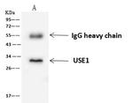 USE1 Antibody in Immunoprecipitation (IP)