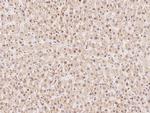 WDR4 Antibody in Immunohistochemistry (Paraffin) (IHC (P))