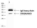 ST6GALNAC5 Antibody in Immunoprecipitation (IP)