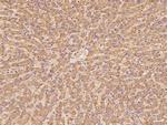 NDUFA13 Antibody in Immunohistochemistry (Paraffin) (IHC (P))