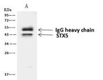 STX5 Antibody in Immunoprecipitation (IP)