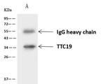 TTC19 Antibody in Immunoprecipitation (IP)