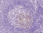 UBE2S Antibody in Immunohistochemistry (Paraffin) (IHC (P))