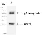 UBE2S Antibody in Immunoprecipitation (IP)