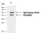 SBCAD Antibody in Immunoprecipitation (IP)