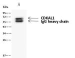 CDKAL1 Antibody in Immunoprecipitation (IP)