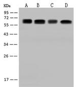 CDKAL1 Antibody in Western Blot (WB)