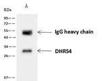 DHRS4 Antibody in Immunoprecipitation (IP)