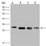 DHRS4 Antibody in Western Blot (WB)