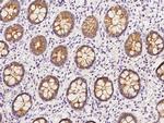 MAP7 Antibody in Immunohistochemistry (Paraffin) (IHC (P))