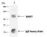 MAP7 Antibody in Immunoprecipitation (IP)