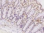 PABPC4 Antibody in Immunohistochemistry (Paraffin) (IHC (P))