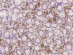 PABPC4 Antibody in Immunohistochemistry (Paraffin) (IHC (P))