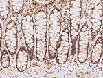 GTF2F2 Antibody in Immunohistochemistry (Paraffin) (IHC (P))