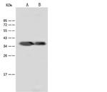 Dengue Virus Type 2 NS5 (strain New Guinea C) Antibody in Western Blot (WB)