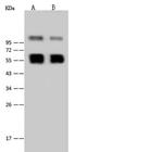 West Nile Virus NS1 (lineage 1, strain NY99) Antibody in Western Blot (WB)
