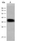 CRELD2 Antibody in Western Blot (WB)